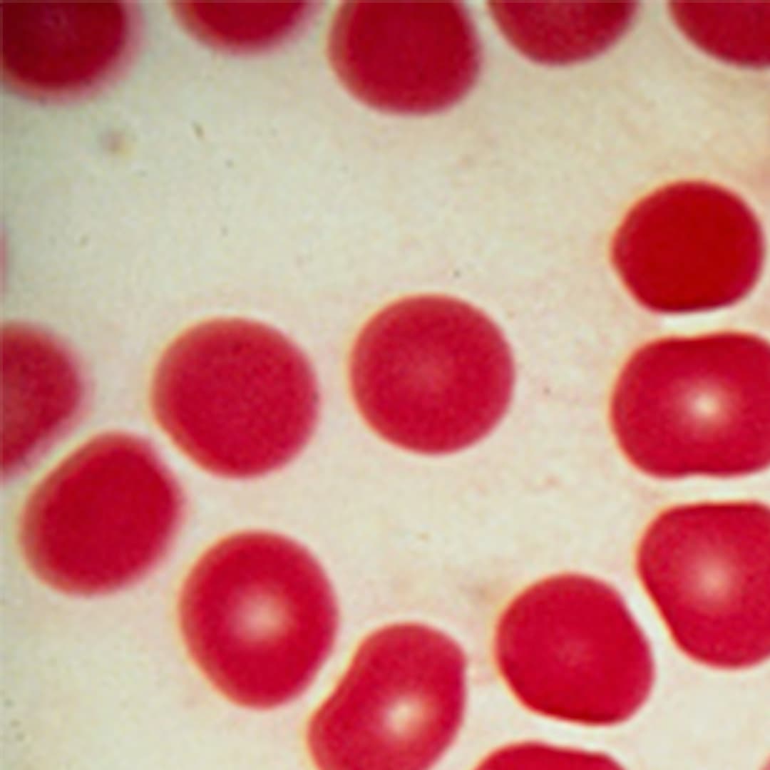 Red Blood Cells Magnified